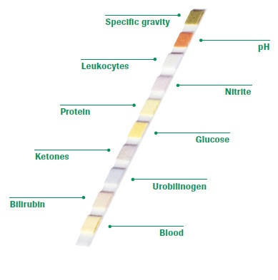 100 urine creatinine test strips, professional quality test  for 10 parameters with FDA,CE,ISO